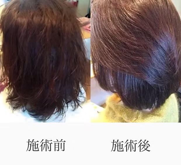 シンリシステムカラー・ビフォーアフター1 | 株式会社ワンウェーブジャパン
