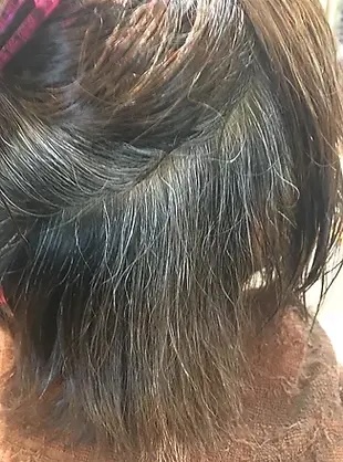染まりにくい箇所(ネープ) | 株式会社ワンウェーブジャパン